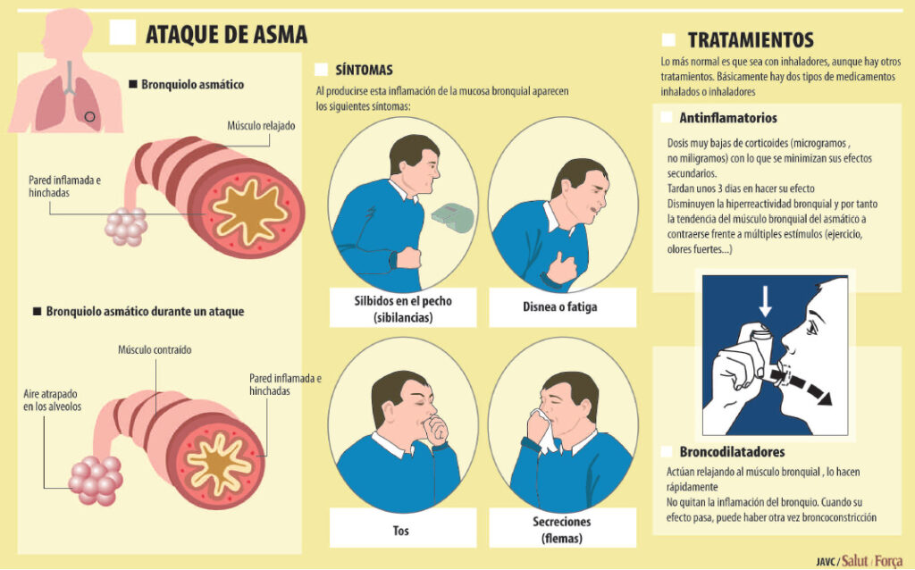 Asma Al Rgico Quedarse Sin Respirar En Primavera Salud Ediciones