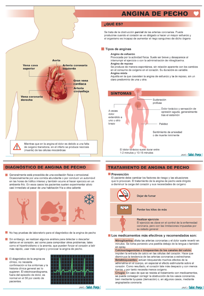 Infarto Agudo De Miocardio Músculo Cardíaco Se Muere Y El Corazón Se Rompe Salud Ediciones 8476